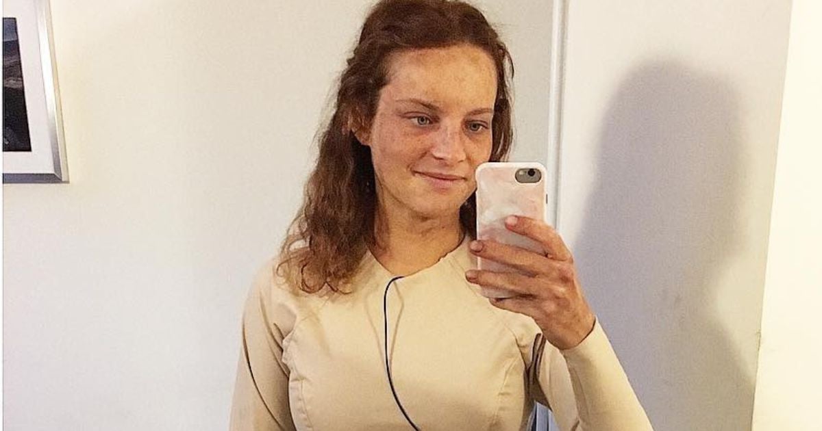 She ate 3 apples a day for 8 months