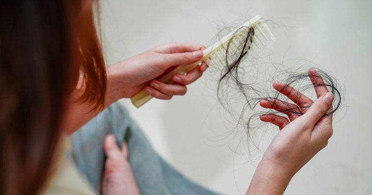 Do Hair Loss Treatments for Women Actually Work? What Experts Think
