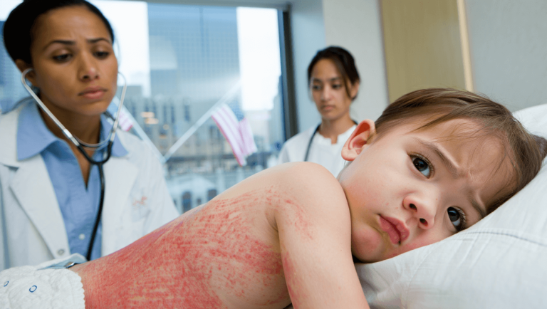 U.S. Poised to Lose Measles Elimination Status Amid Ongoing Outbreaks
