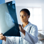 New Breast Density Treatment May Have Fewer Side Effects, Lower Cancer Risk