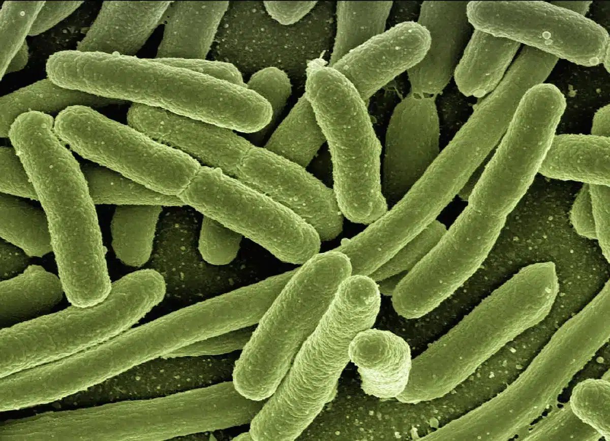 Microscopic view of Shiga toxin-producing E. coli bacteria
