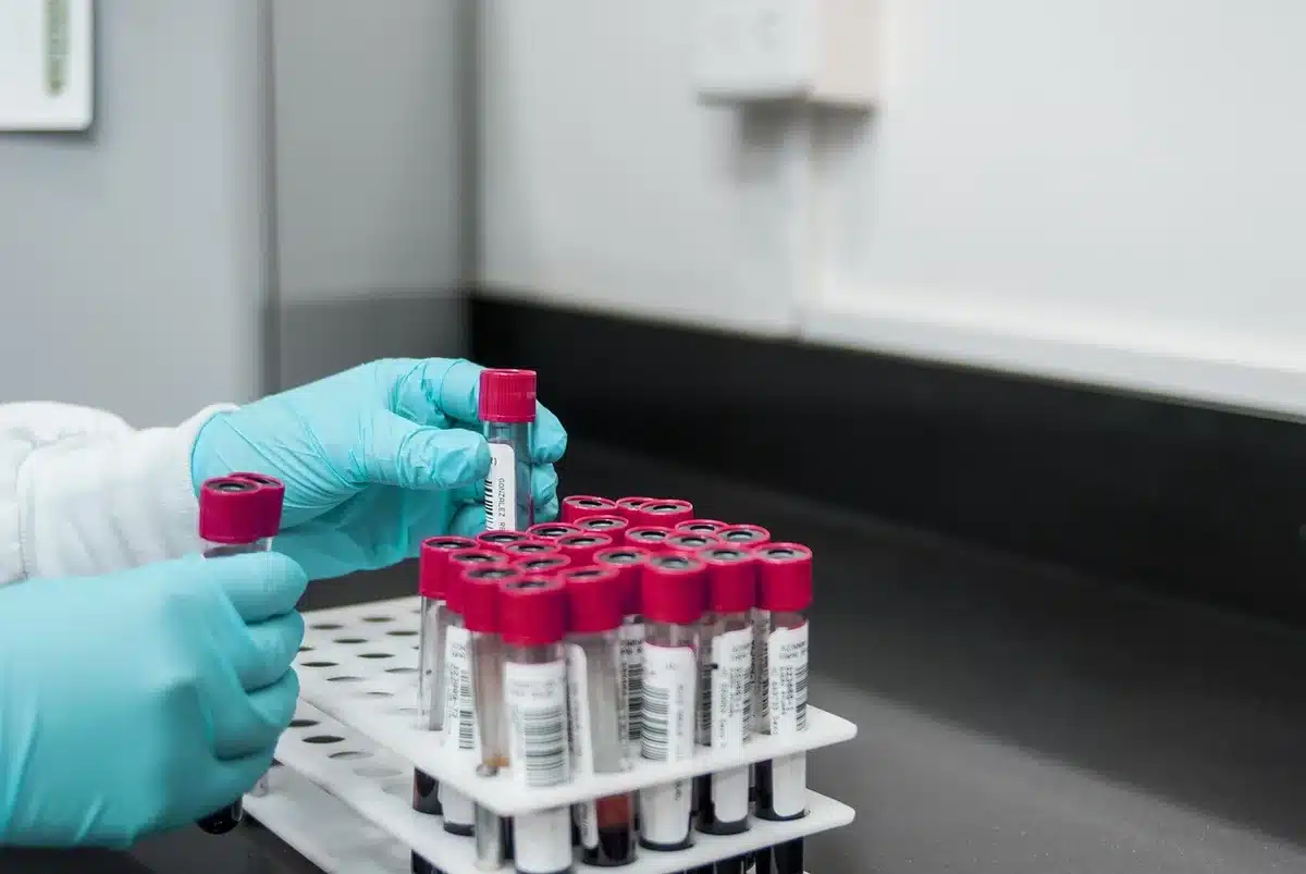 Healthcare professional drawing blood sample during morning medical appointment