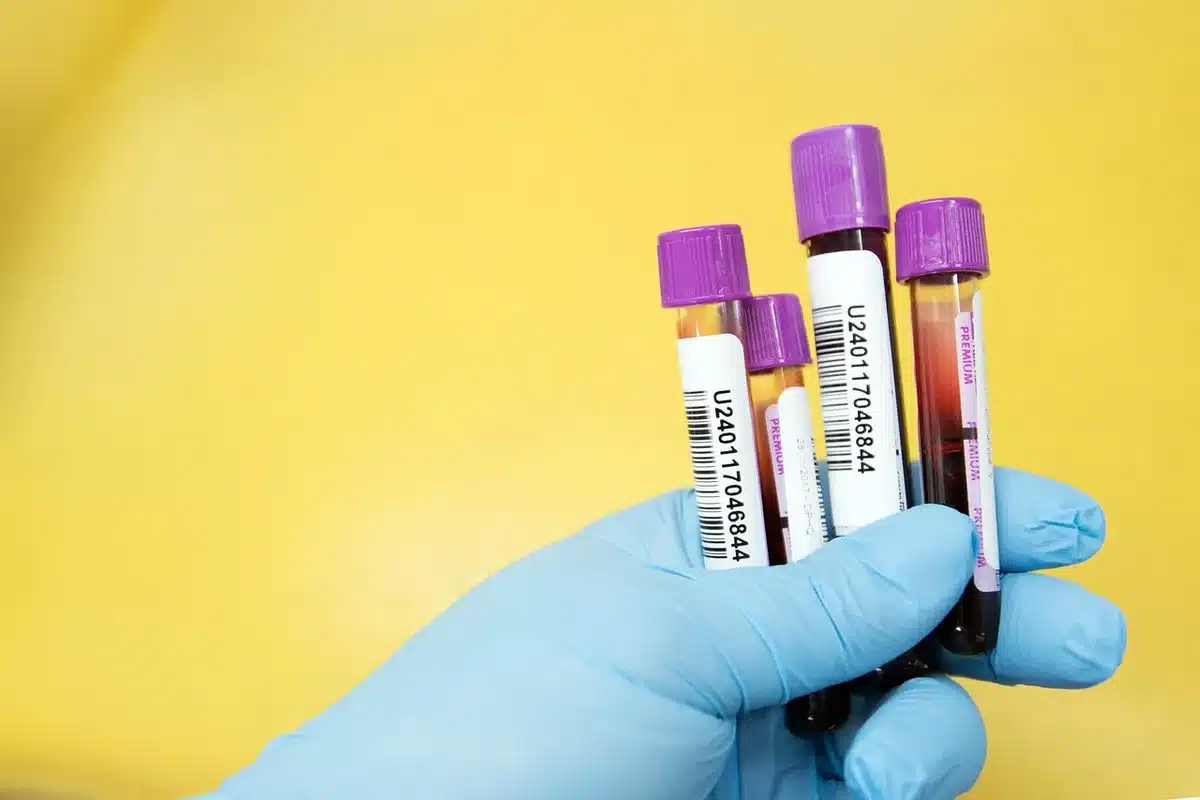 Hands holding a small blood collection tube on a clinic table with an information leaflet visible